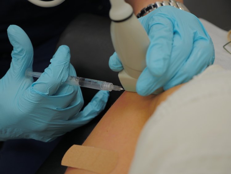 Trigger Point Injections Network Spine