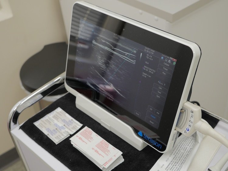 Mobile Ultrasound Screen for Pre-Procedural Diagnosis